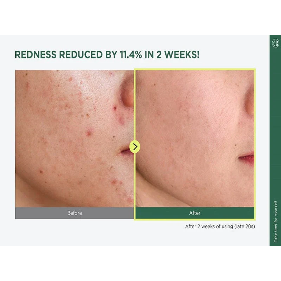 Heartleaf 77% soothing toner (Anua) -150ml Tónico Pieles Sensibles 77% Houttuynia Cordata  3