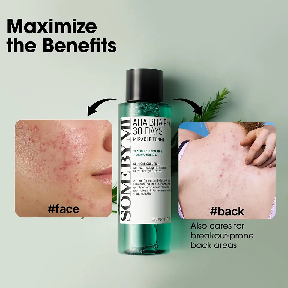 AHA BHA PHA 30 Days Miracle Toner (Some By Mi) - 150ml Tónico para pieles con problemas 2