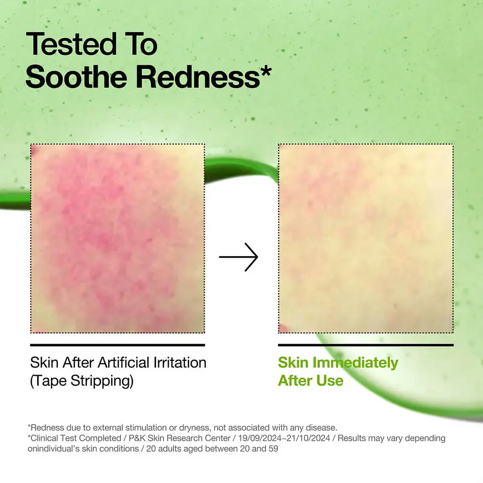 Azelaic Acid 10 Hyaluron Redness Soothing Serum (ANUA) - 30ml  4