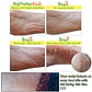 Witch Piggy Hell-Pore Turtle's Foot Pack (Elizaveccca) - Mascarilla exfoliante para pies - Miniatura 4