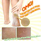 Witch Piggy Hell-Pore Turtle's Foot Pack (Elizaveccca) - Mascarilla exfoliante para pies - Miniatura 5