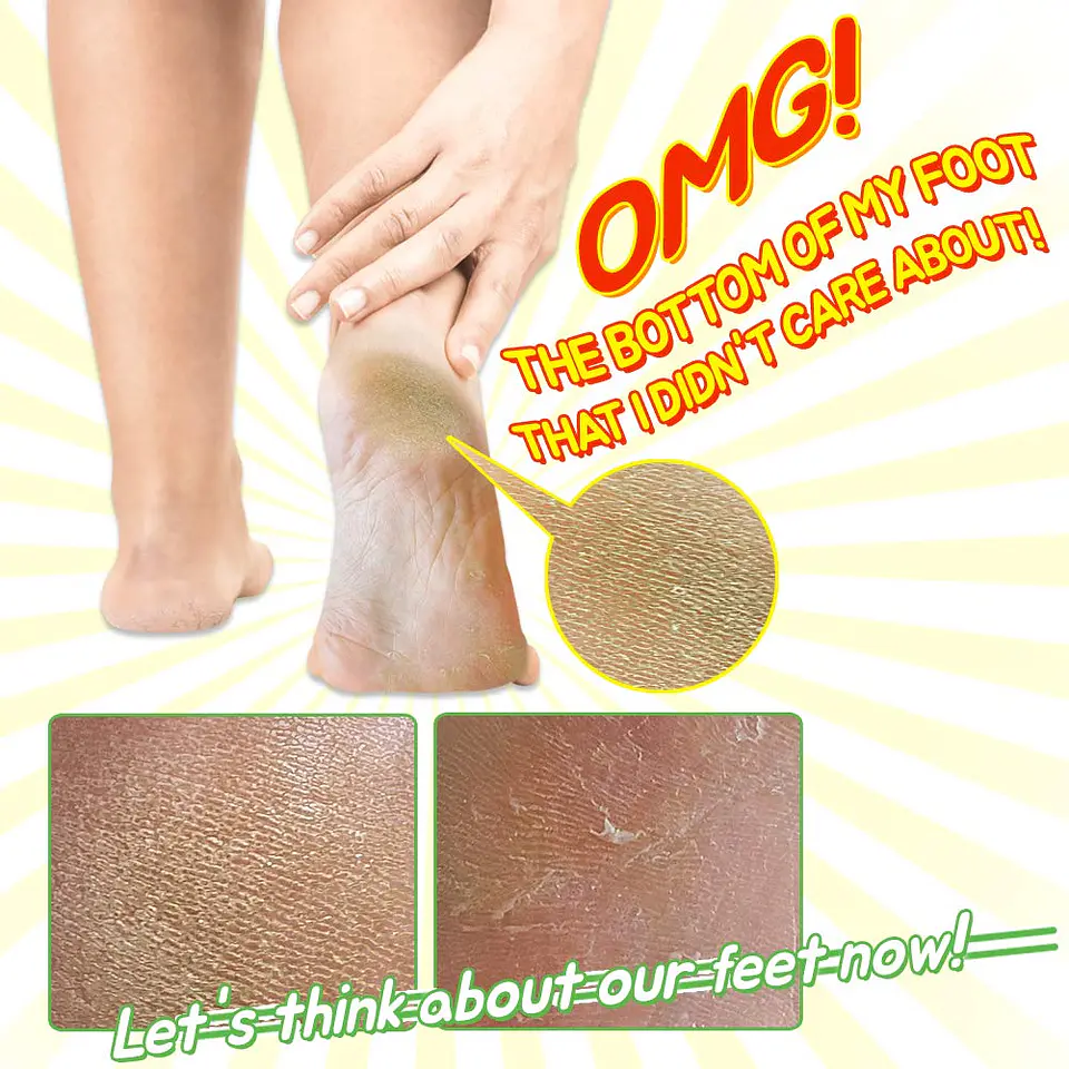 Witch Piggy Hell-Pore Turtle's Foot Pack (Elizaveccca) - Mascarilla exfoliante para pies 5