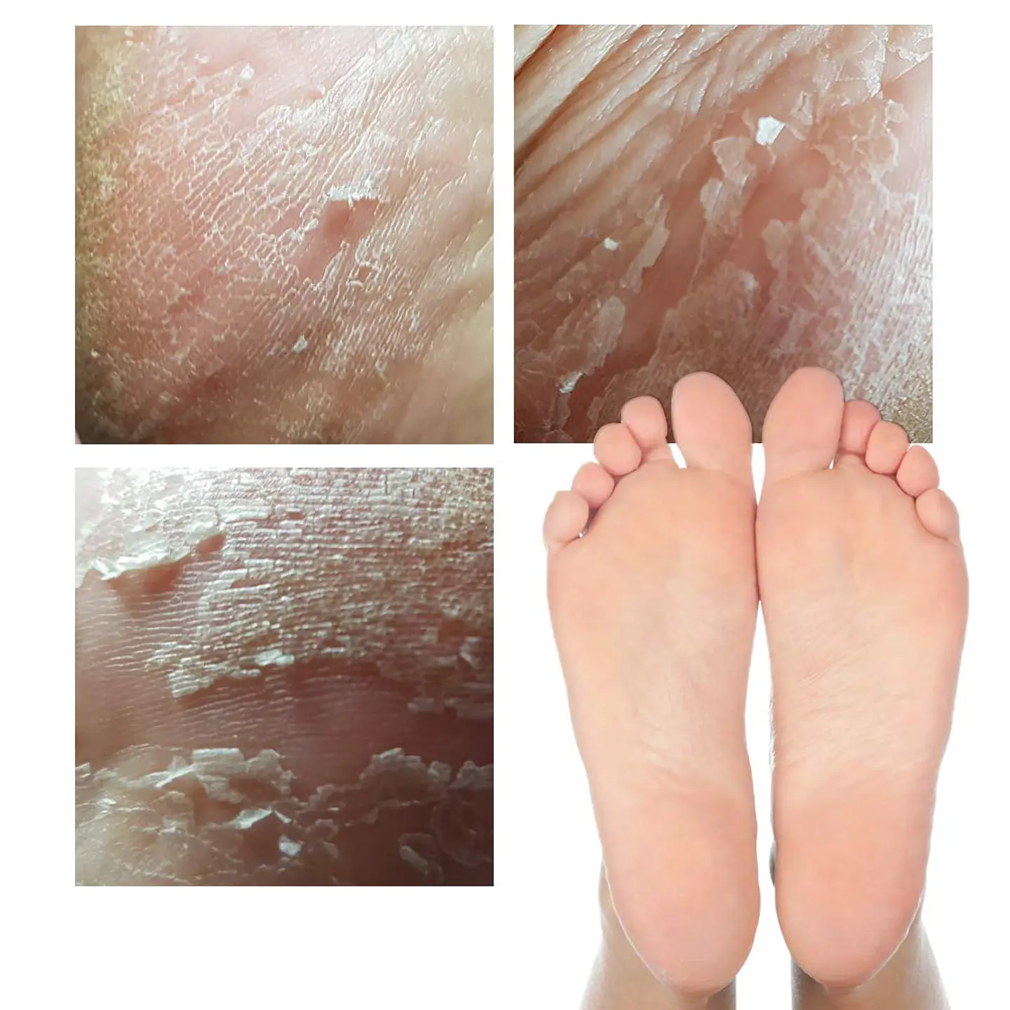 Witch Piggy Hell-Pore Turtle's Foot Pack (Elizaveccca) - Mascarilla exfoliante para pies 6