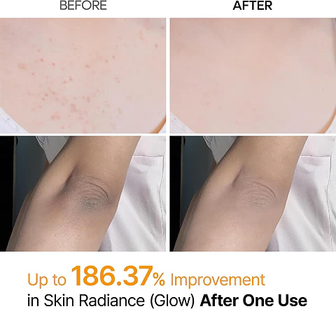 Peel Shot Exfoliating Kojic Acid Turmeric Spray (Dr Melaxin) - 200ml - Tratamiento exfoliante en spray