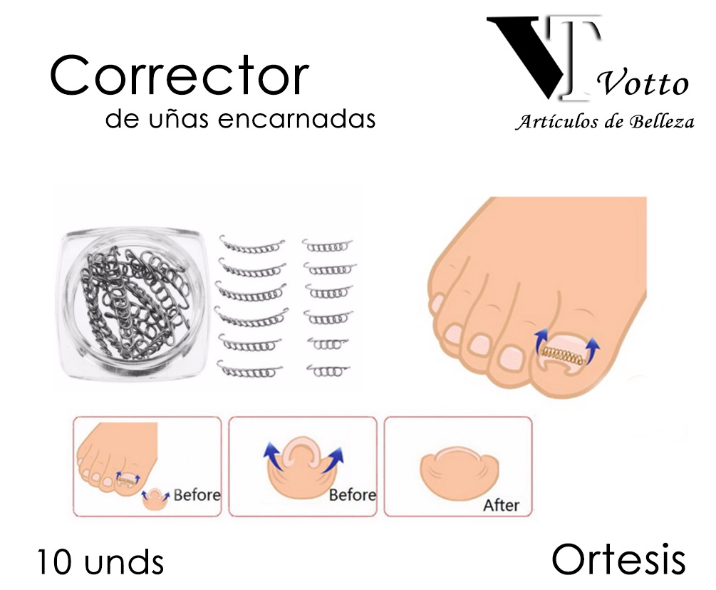 Corrector de Uñas Encarnadas Ortesis