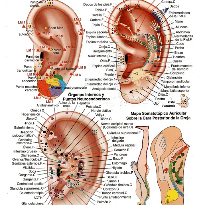 Cartografía Plastificada Puntos del Microsistema Auricular 1