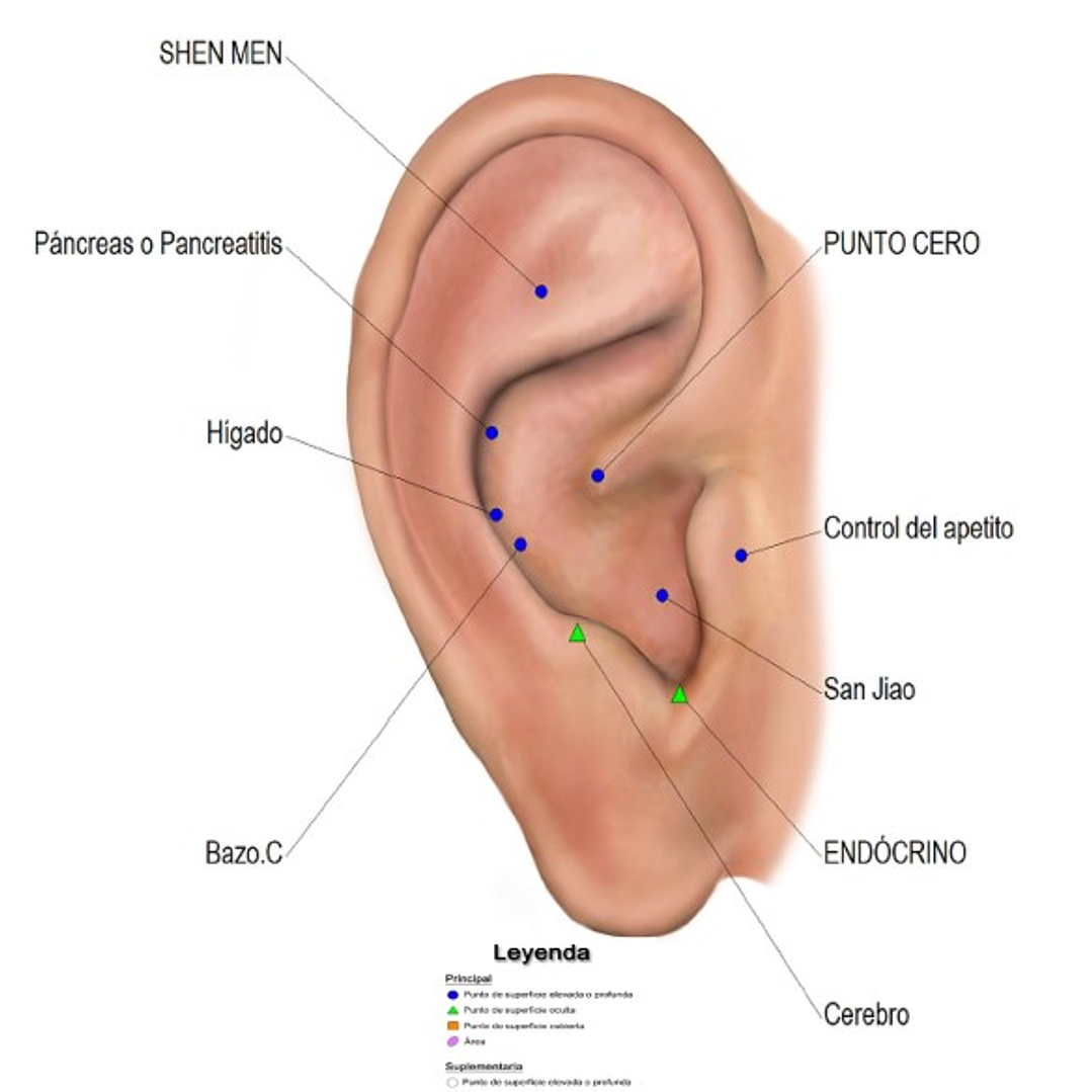 Cartografía Auriculoterapia (Tamaño Carta) Diabetes Melitus 1