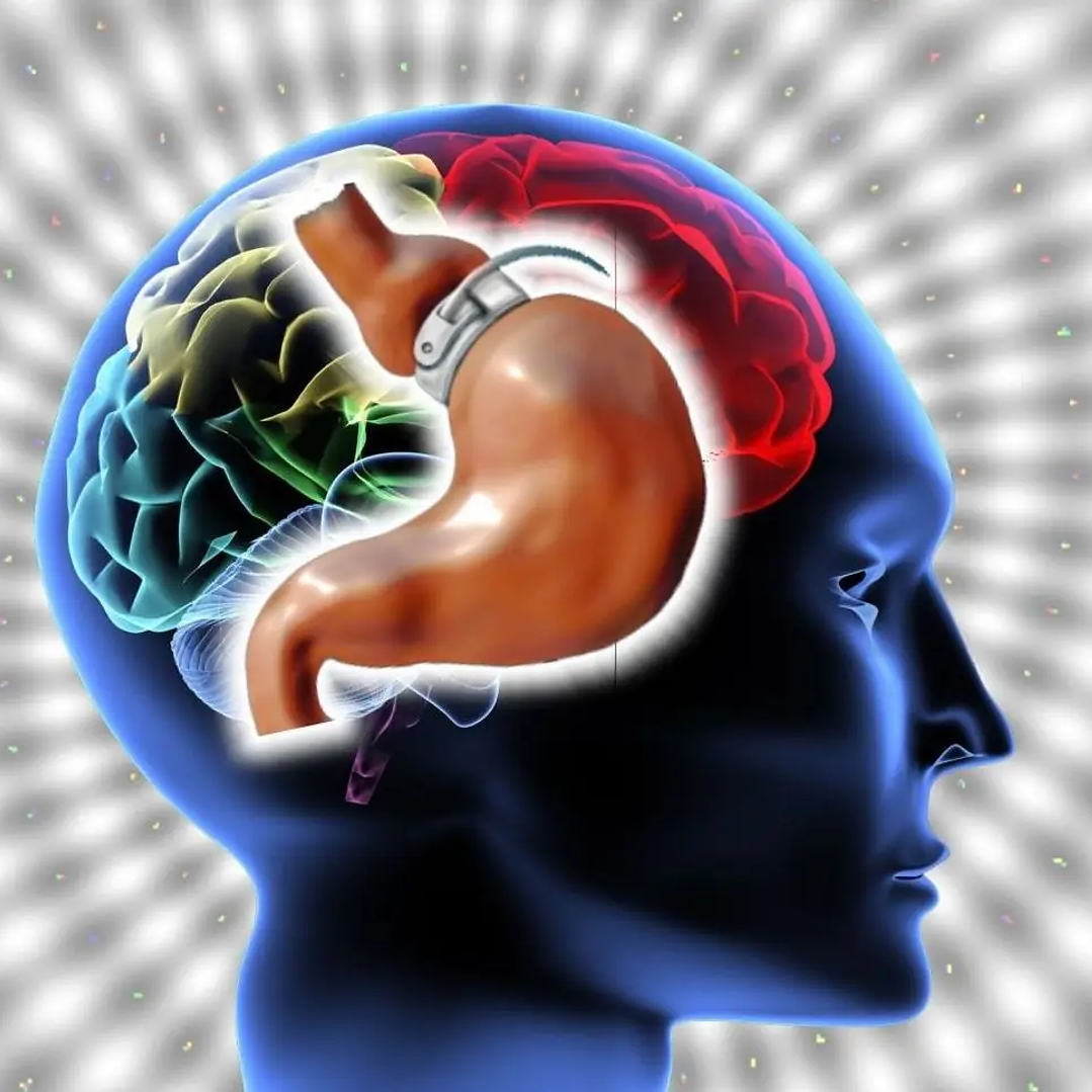 Banda Gástrica Virtual 2