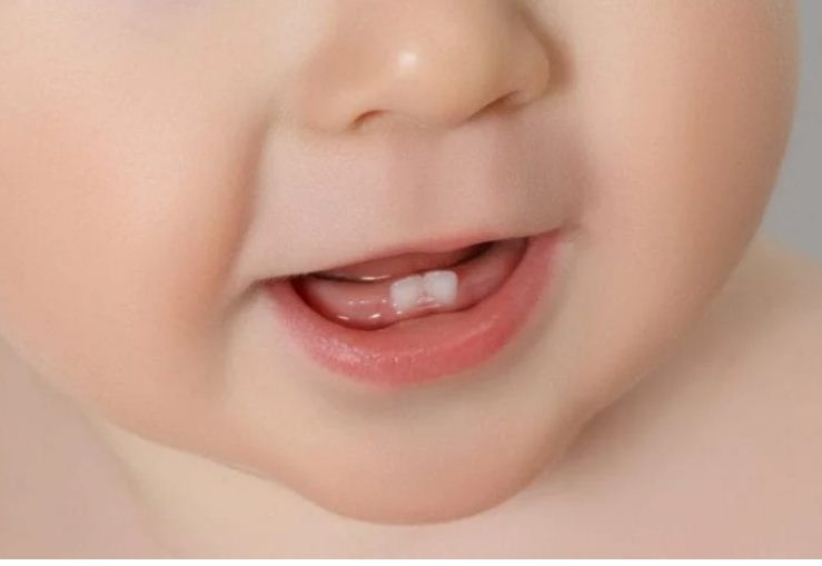 Una boca saludable para tu bebé Parte 2