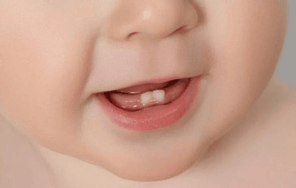 Una boca saludable para tu bebé Parte 2