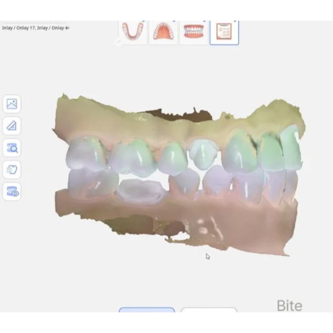 IOS 2 | Escaner Oral | RAY