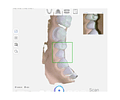 IOS 2 | Escaner Oral | RAY