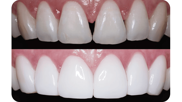 CURSO Impresión 3D Profesional en Odontología 7 Y 8 De Agosto 5