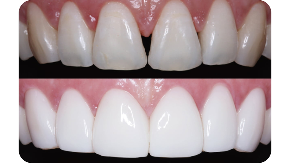 CURSO Impresión 3D Profesional en Odontología 7 Y 8 De Agosto 5