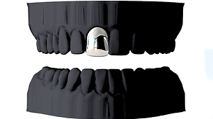 Dientes Simples ( Desde 1 a 20 tu seleccionas la cantidad)