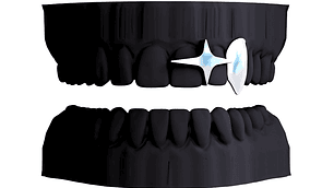 Colmillo + Destello Alargado