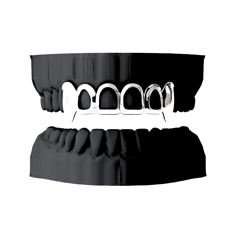 4 Ventanas + 2 Caps 1