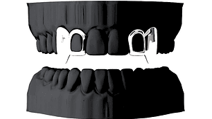 2 Colmillos + 2 Ventanas