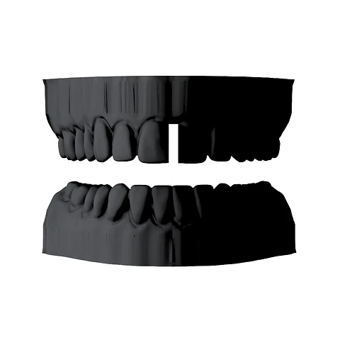 Diastema Clasica