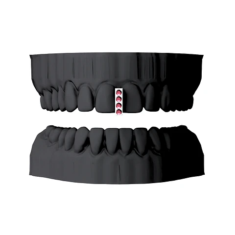 Diastema + Circones