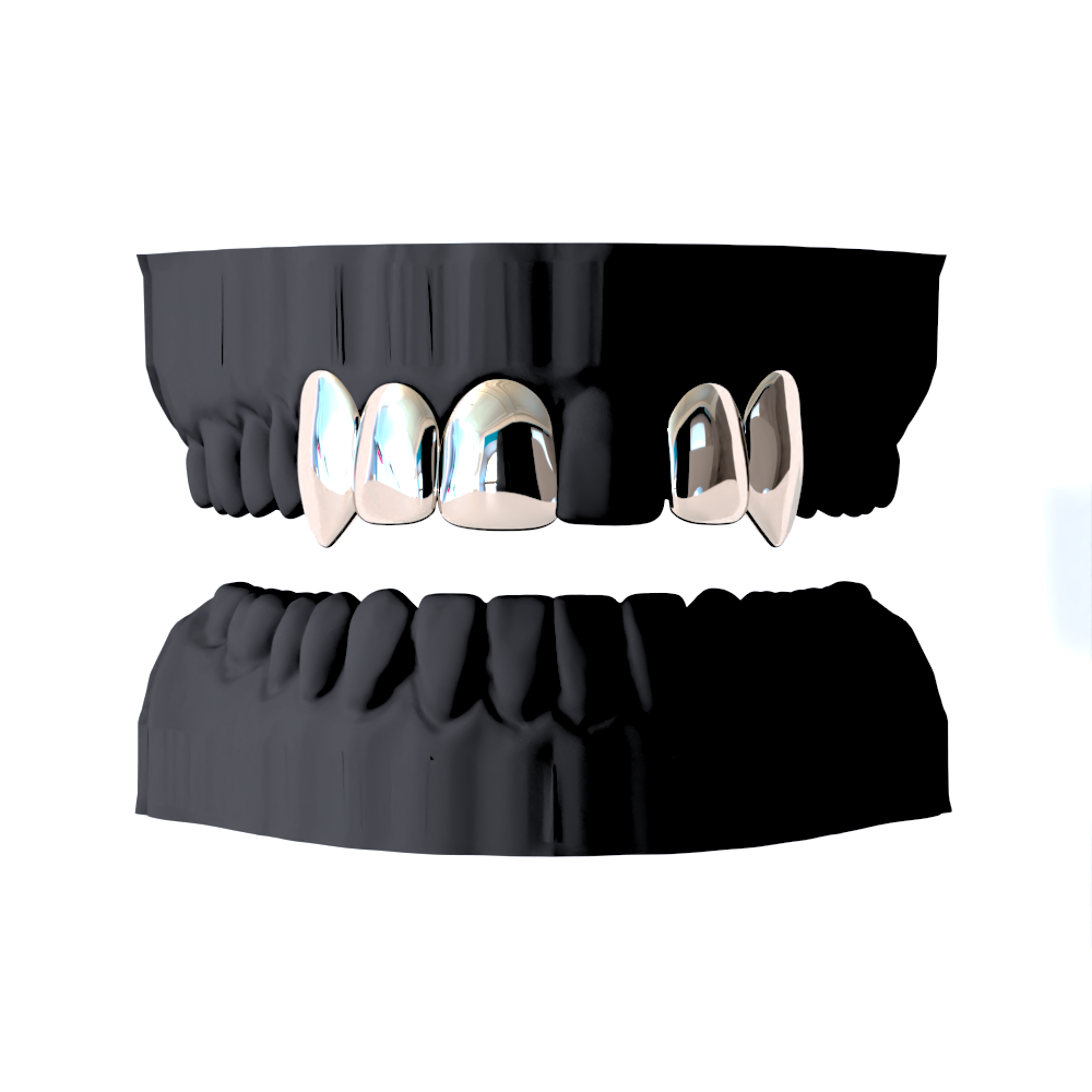 DIENTES CAP O VENTANAS PROMO ESTUDIANTE (TU ESCOGES LA CANTIDAD) 5