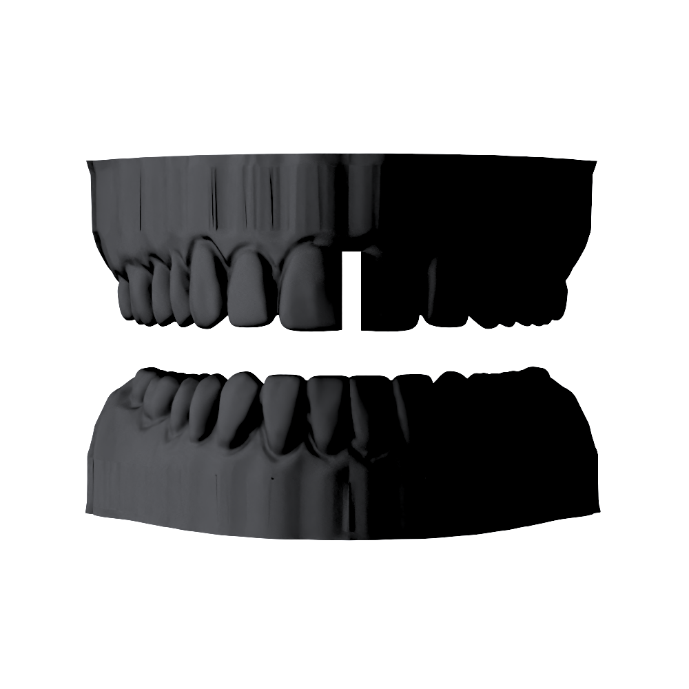 DIASTEMA SIMPLE - FLASH GRILLZ DAY  1