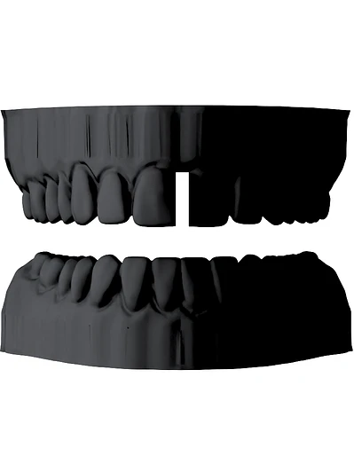 DIASTEMA SIMPLE - FLASH GRILLZ DAY 