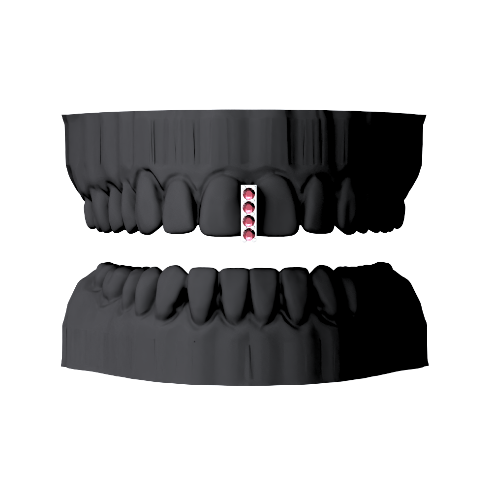 DIASTEMA CON CIRCONES - FLASH GRILLZ DAY  1