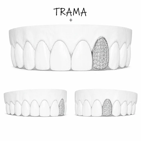 Ice Grillz con Moissanitas