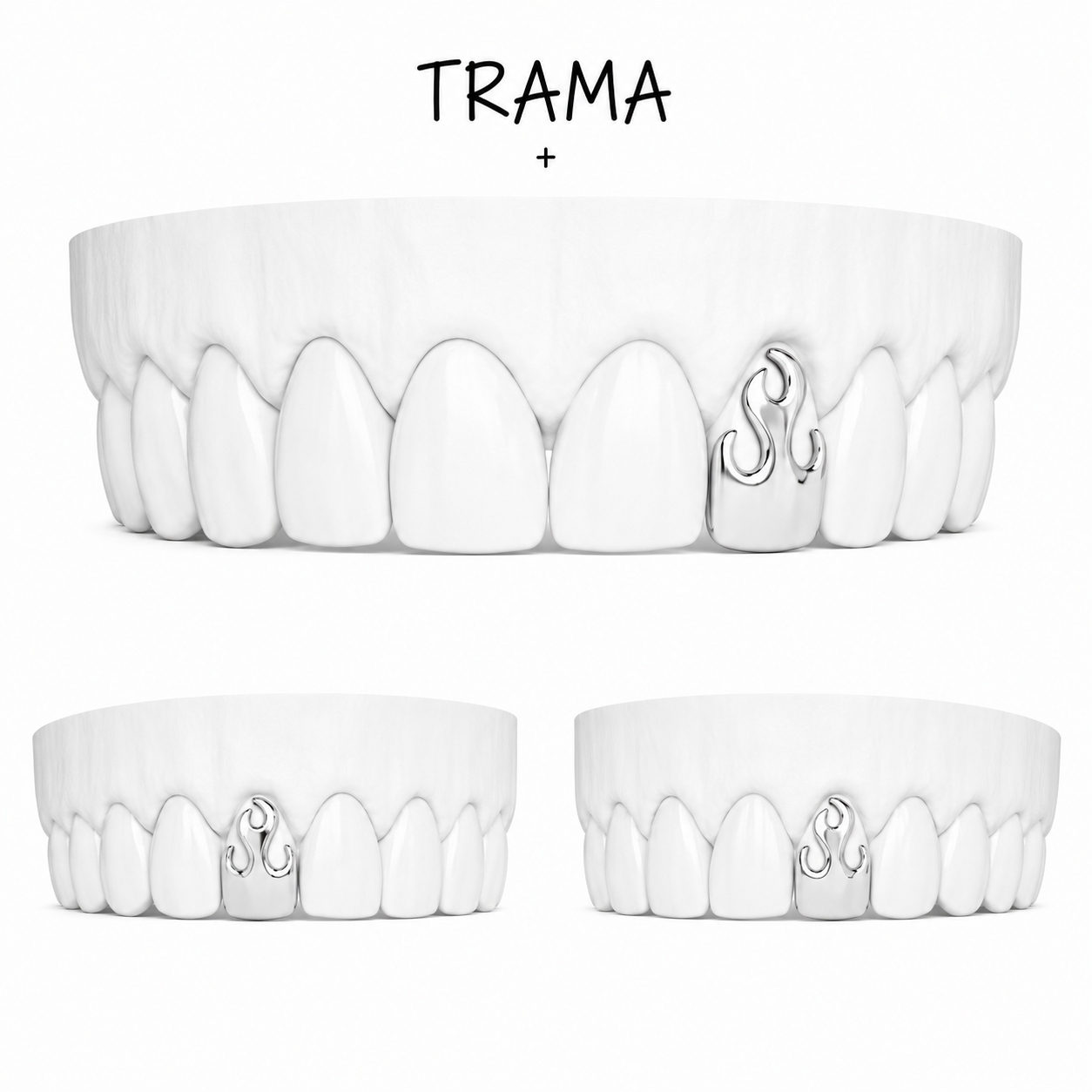 Flama 1