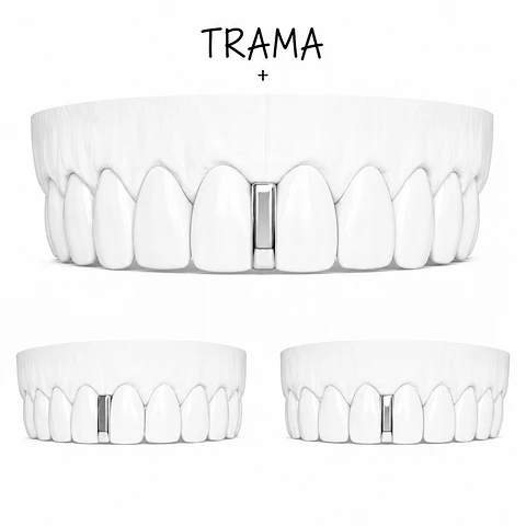 Diastema Clasica