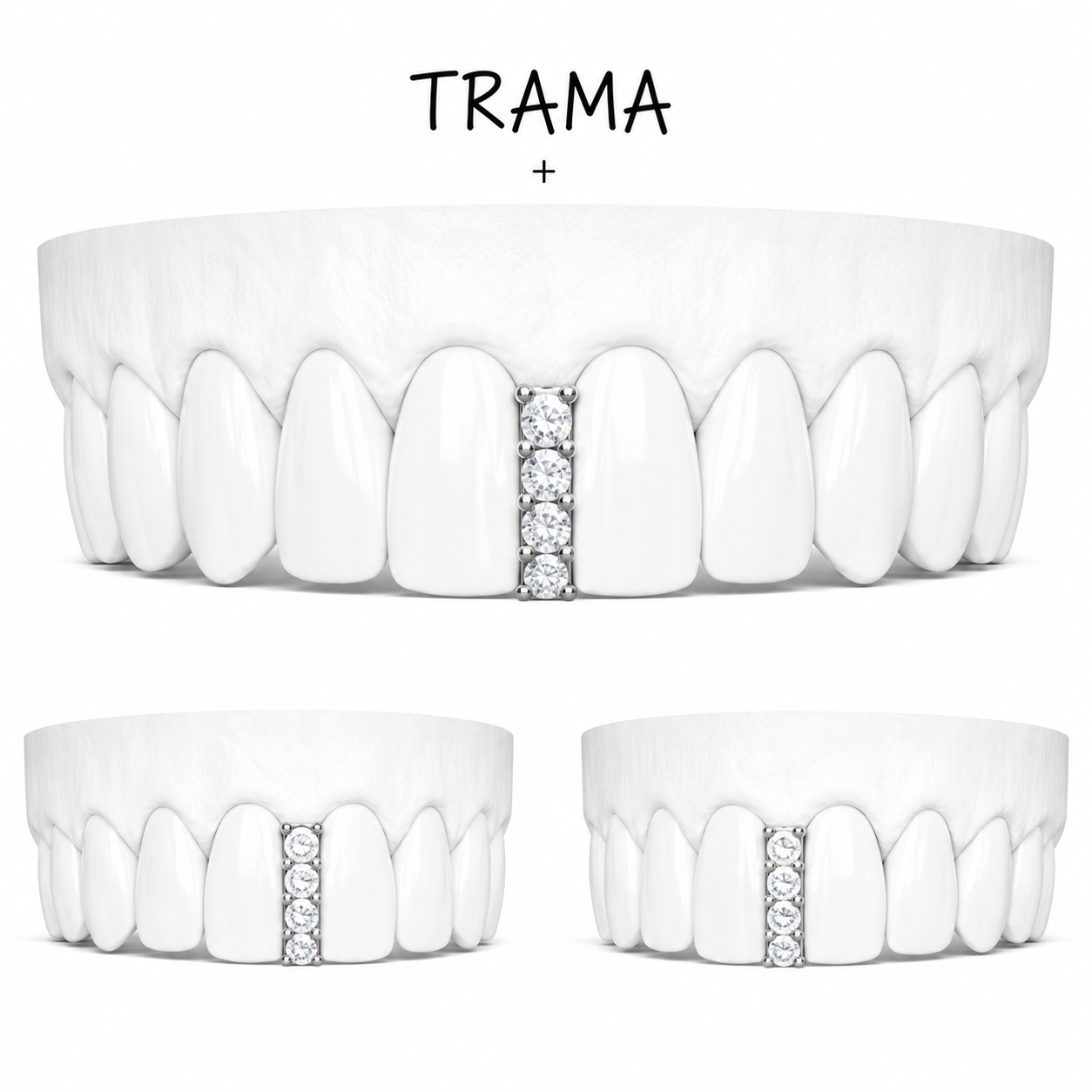 Diastema + Circones 1