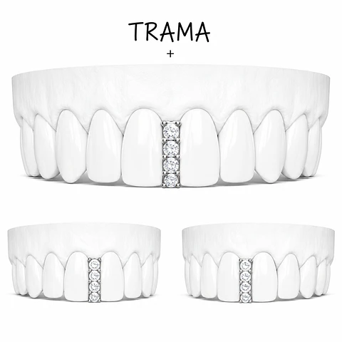Diastema + Circones