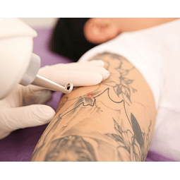 Formação em Remoção de Tatuagens a Laser e Peeling Hollywood