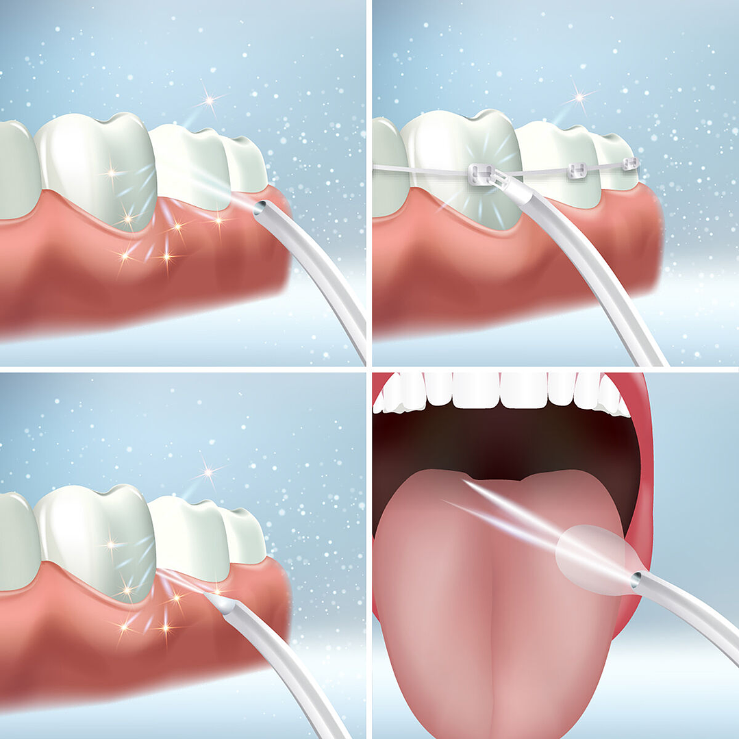 Irrigador Dental Recargable Portátil Denter InnovaGoods – Limpieza Bucal Profesional en Casa con Tecnología Inalámbrica e Impermeable 5