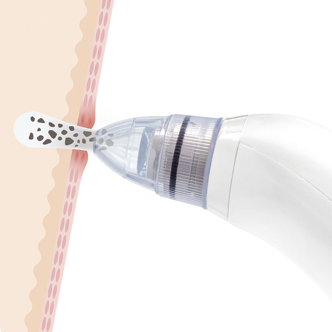 Limpiador Facial Eléctrico Pore·Off InnovaGoods – Elimina Puntos Negros, Grasa y Piel Muerta con Succión Profesional 6