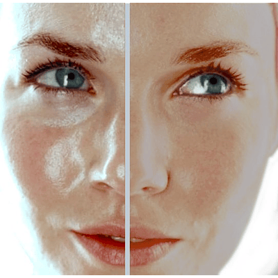 ¿Cómo cuidar la piel grasa y que productos debería comprar para cuidar mi rostro?