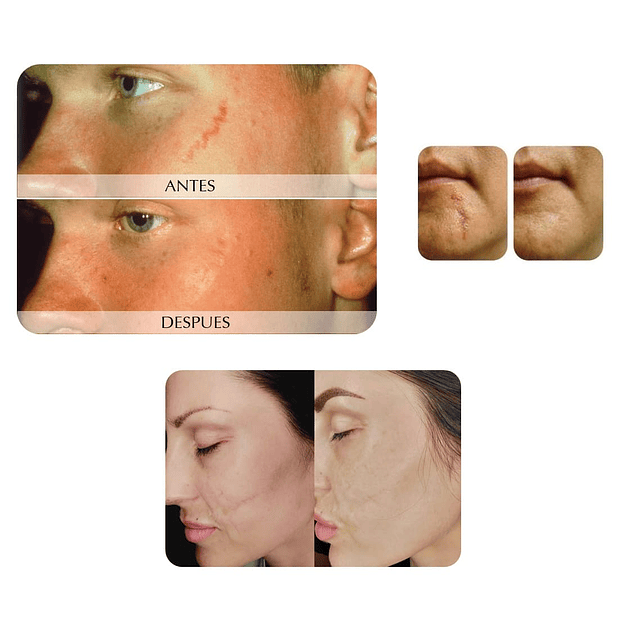 Serum reparador celular Dr. Fontboté cicatrices revitalizante anti edad arrugas