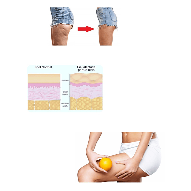 Aceite celulitis masajes drenantes elimina piel de naranja en el cuerpo pack 2