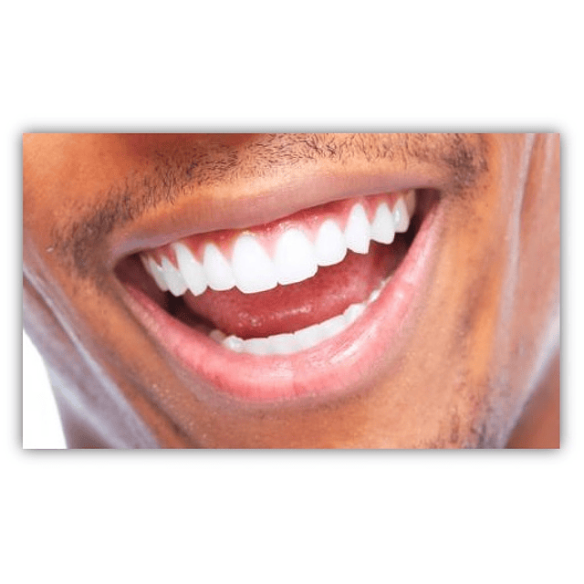 Pasta blanqueamiento dental pulidora blanqueadora manchas dientes sarro