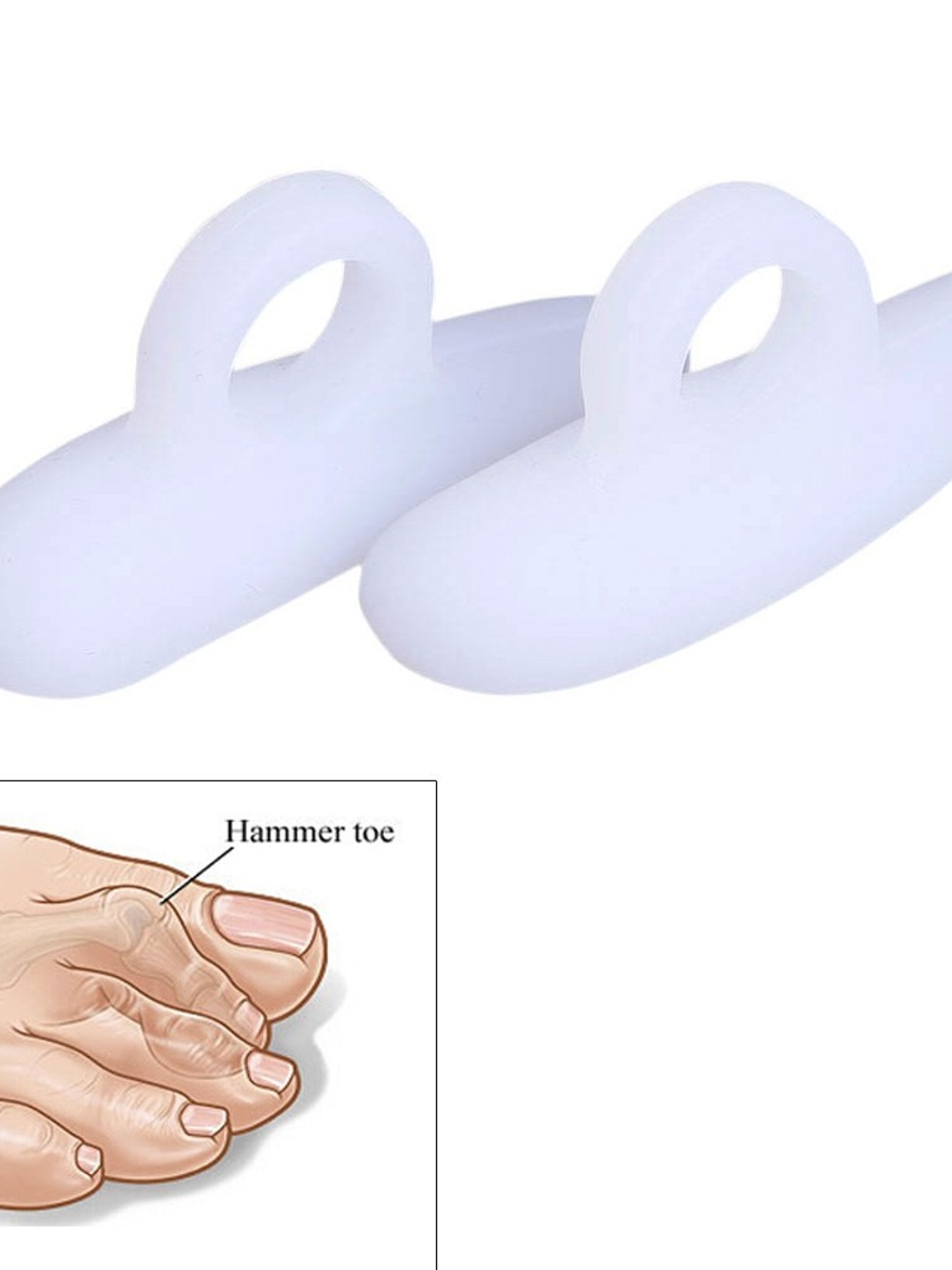 Corrector Dedo en Garra, Dedo Martillo 2