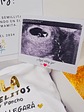 Baby Reveal – Caja de anuncio de embarazo personalizada - vignette 3