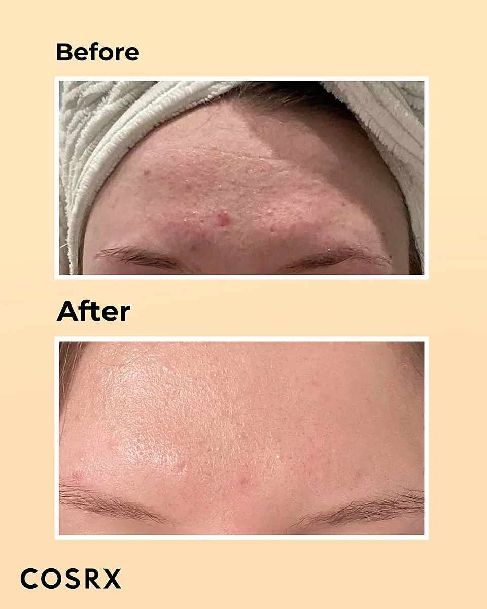 Advanced Snail 96 Mucin Power Essence (COSRX) - 100ml Esencia 96% baba de caracol 11