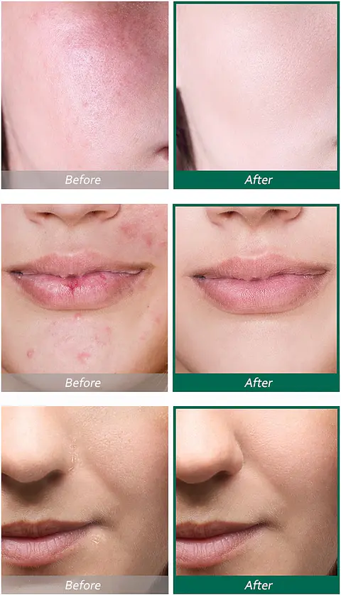 AHA BHA PHA 30 days Miracle Serum (Some By Mi) - 50ml Serum exfoliante anti imperfecciones