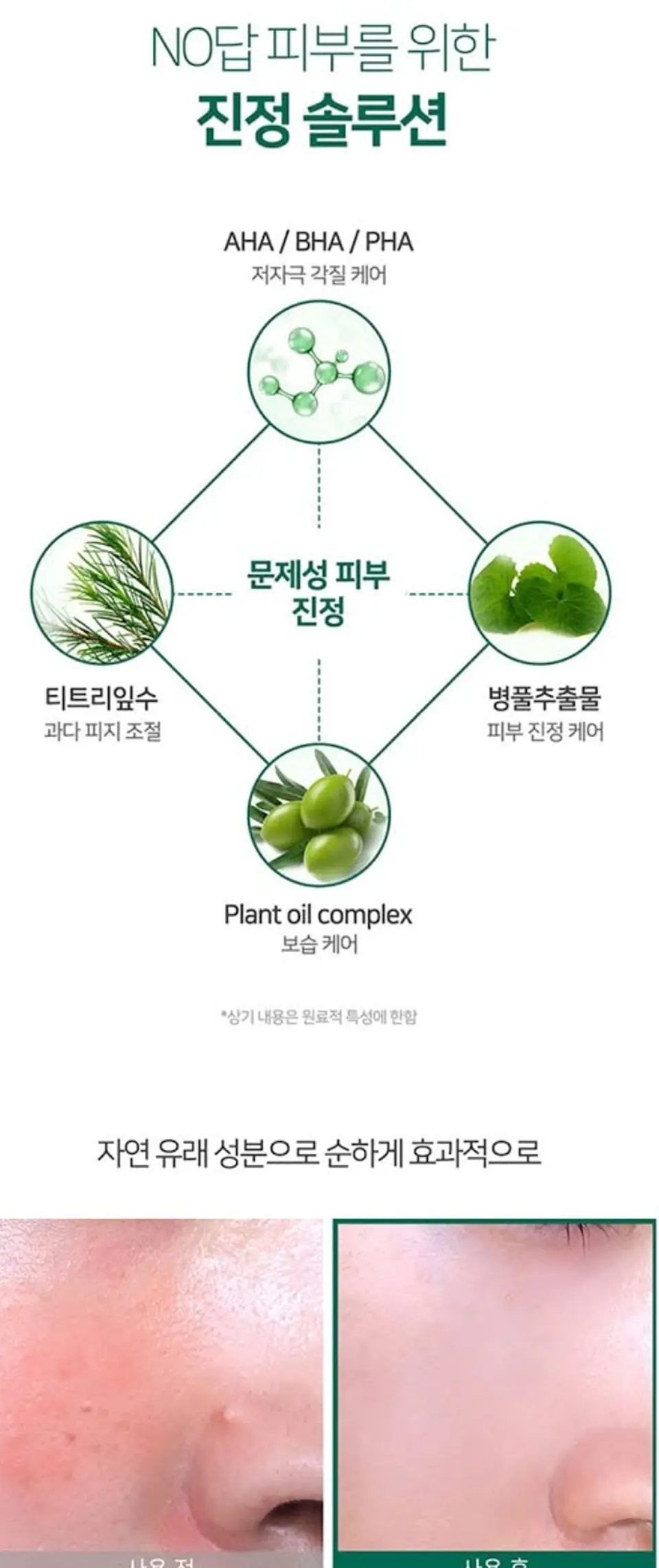 AHA BHA PHA 30 days Miracle Serum (Some By Mi) - 50ml Serum exfoliante anti imperfecciones 3