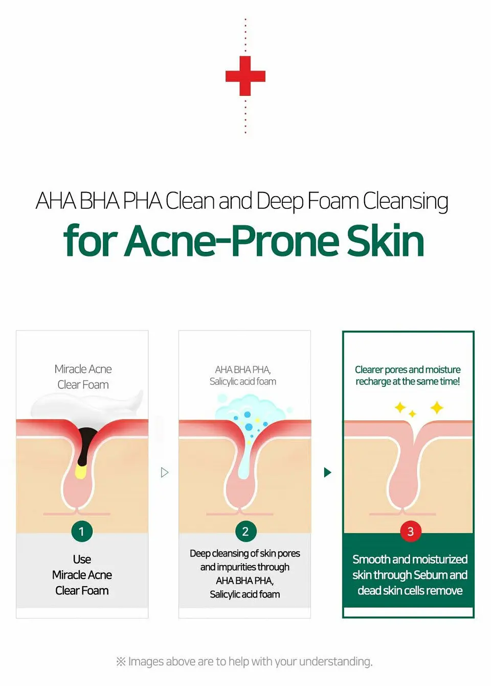 AHA-BHA-PHA 30 Days Miracle Acne Clear Foam (Some By Mi) – 100ml Limpiador pieles problemáticas 3