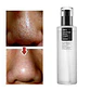 BHA Blackhead Power Liquid (COSRX) - 100ml Tratamiento puntos negros y acné - Miniatura 2