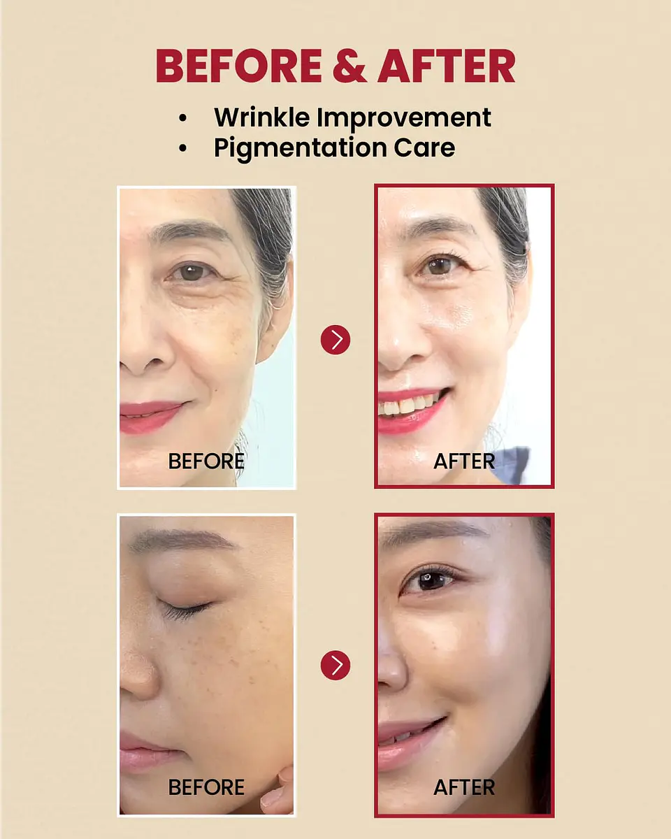 Seoul 1988 Serum: Retinal Liposome 2% + Black Ginseng (K-Secret) - 30ml  Serum antiedad con retinal y ginseng  7