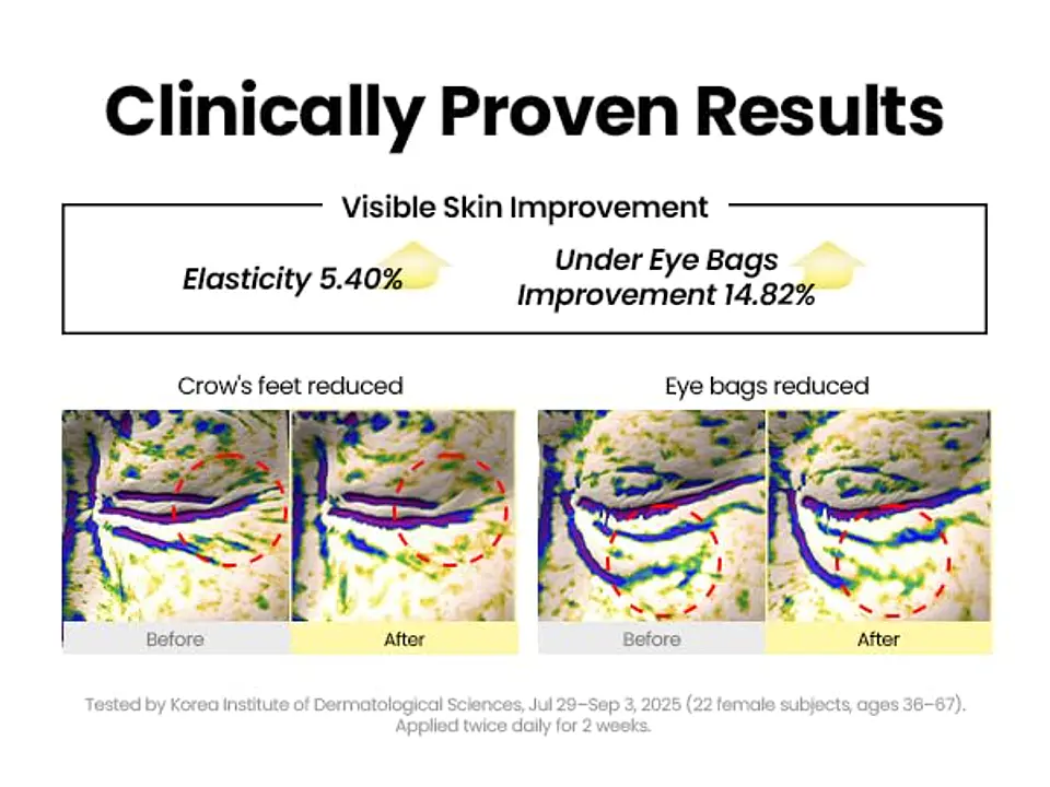 Seoul 1988 Eye Cream: Retinal Liposome 4% + Fermented Bean (K-Secret) -30ml Crema contorno de ojos antiedad con retinal, bakuchiol y péptidos 7
