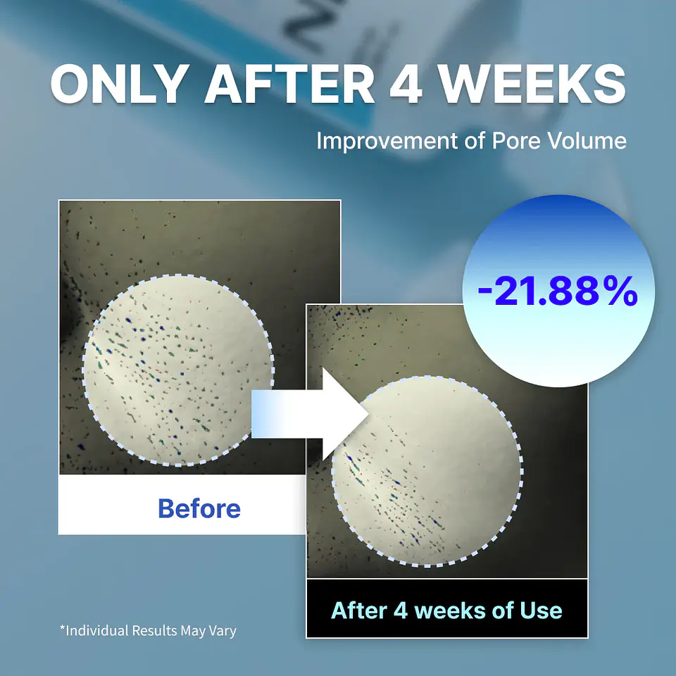 Youthful Formula™ Ultimate Moisturizing Cream (NIDA) - Crema antiedad con colágeno, péptidos, niacinamida y centella asiática 15